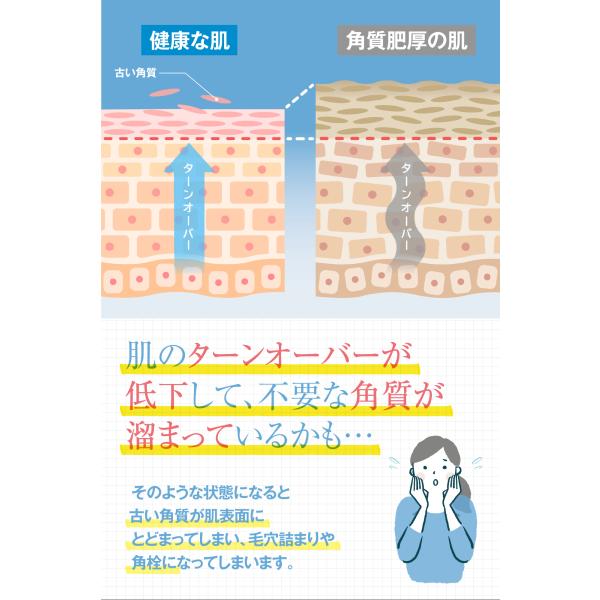 ニキビ予防&角質ケア