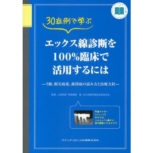 30症例で学ぶエックス線診断を100 臨床で活用するには う蝕 歯科学全般 根尖病変 歯科学 歯周病の読み方と治療方針 ぐるぐる王国 ぐるぐる王国 スタークラブ