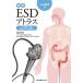 ESD Atlas 10 2 палец .* большой .* повсеместный Live . пример сборник /.. высота история 