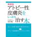  атопия . кожа .. надежно ..книга@ новейший версия / большой стрела ..