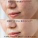 �����b�V���|�[ ���� B3 �Z���� 30mL ���e�t �����W�� MELASYLTM �i�C�A�V���A�~�h ���`�m�[���U���� �q�A�������_ �q���� ������ ���K�i�ۏ� �֘A�摜4