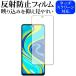 Xiaomi Redmi Note 9S ��p ���˖h�~ �m���O���A �t�� �ی� �t�B���� �݊��i