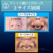 �I�[�v���m�[�Y 2�g ���{�� �@�p�O�b�Y �@�ċz�T�|�[�g �@�܂�� ������ �������� �@�p ���т��΍�O�b�Y ���� �֘A�摜5