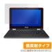 ASUS Chromebook Flip C213NA-BW0045  ݸ ե OverLay Plus for ASUS Chromebook Flip C213NA-BW0045 ݸ ȿ