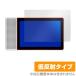 Lenovo Smart Display M10 для защитная плёнка OverLay Plus for Lenovo Smart Display M10 жидкокристаллический защита anti g редкость низкий отражающий не глянец . отпечаток пальца Lenovo Smart tis
