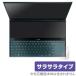 ZenBook Pro Duo UX581GV ȥåѥå ݸ ե OverLay Protector for ASUS ZenBook Pro Duo UX581GV ݸ 쥢 餵꿨 ֥å 