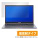 ASUS X515JA 2022 ݸ ե OverLay Plus for ΡPC X꡼ X515JA 2022 վݸ 쥢 ȿ  ɻ