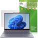 Lenovo IdeaPad 5i 5 2-in-1 Gen 10 14 type защитная плёнка OverLay Brilliant for I der накладка жидкокристаллический защита отпечаток пальца . есть трудно высота глянец . покупка 