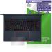 MSI Stealth 16 AI Studio A1V Touch накладка защитная плёнка OverLay Protector for стойка rus16 защита anti g редкость .... рука ... покупка 