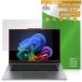 Lenovo ThinkPad X9 15p Gen 1 Aura Edition 15.3 type Intel защитная плёнка OverLay Plus for Lenovo раковина накладка anti g редкость отпечаток пальца предотвращение . покупка 