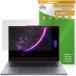 Lenovo Yoga Pro 7i Gen 11 Aura Edition 15.3 type Intel защитная плёнка OverLay Plus for Lenovo йога anti g редкость отражающий предотвращение отпечаток пальца предотвращение 