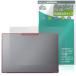 Lenovo Yoga Pro 7i Gen 11 Aura Edition 15.3 type Intel настольный защитная плёнка OverLay антибактериальный Brilliant for Lenovo йога .u il s высота глянец 