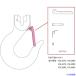 #KITO защелка комплект VAL3080 P3HT08011911(5683511)