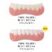  подлинный товар * стандартный товар мгновенный Smile внизу зуб для для мужчин и женщин простой установка зуб искусственный зуб простой установка зуб выпадение зуб зуб. .. зуб средний .... зуб желтый зуб нет разряд зуб покрытие 