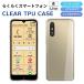 �炭�炭�X�}�[�g�t�H��Lite �P�[�X �炭�炭�X�}�[�g�t�H��a �X�}�z�P�[�X �J�o�[ �X�[�p�[�N���A TPU ���� �V���v�� �炭�炭�X�}�z a lite A401FC MR01