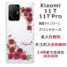 Xiaomi 11t Pro  㥪11tץС 饤󥹥ȡ 襤 ե  դ ̾  ԥ 