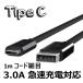  модель C USB кабель 1m /5V/3A внезапный скорость зарядка соответствует разъединение предотвращение первоклассный данные сообщение соответствует черный / белый Tipe-C