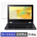 Acer Chromebook Spin 511 ( R756TN /  R756T ) �ݸ�ե���� ȿ���㸺 �֥롼�饤�ȥ��å� �ե���� ������