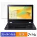 Acer Chromebook Spin 511 ( R756TN /  R756T ) �ݸ�ե���� �������� �֥롼�饤�ȥ��å� �ե���� ������