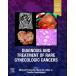 Diagnosis and Treatment of Rare Gynecologic Cancers (Hardcover)