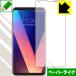 LG V30 / LG V30+ üǻΤ褦Ϥ¸ݸե ڡѡ饤 (̤Τ)
