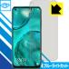 HUAWEI nova 7i LED�վ����̤Υ֥롼�饤�Ȥ�35%���åȡ��ݸ�ե���� �֥롼�饤�ȥ��åȡڸ�����
