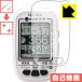 Shot Navi NEO2 EX/NEO2/NEO2 Lite/NEO2 HP природа . есть ..... царапина . восстановление! защитная плёнка царапина сам восстановление 