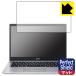 Acer Aspire 5 (A514-54꡼) Perfect Shield ݸ ե 3 ȿ㸺 ɻ 