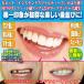 インスタントスマイルティース「コンフォートフィット」（付け歯,歯並び,上歯,審美,薄く,欠け歯,黄ばみ歯,すきっ歯,フィット感アップ,男女兼用)