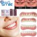  instant Smile on tooth for under tooth for man and woman use go in tooth artificial tooth simple front tooth . tooth difference . tooth attaching tooth gift packing correspondence 