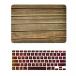 2 in 1 PC TOP CASE - Macbook Wood Texture Pattern Hard Case Cover + Keyboard Cover for Old Macbook Pro 13