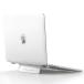 MiRowy кейс MacBook Air 13 (13.6 дюймовый ) соответствует 2026 2025 2024 2023 2022 продажа M5 M4 M3