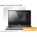 OverLay Plus for Acer Chromebook C720
