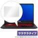 ASUS TUF Gaming FX705GM / FX504GD  ȥåѥå ݸ ե OverLay Protector  ݸ 쥢 餵꿨