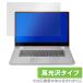 Ideapad C340 15 ݸ ե OverLay Brilliant for Lenovo Ideapad C340 (15) վݸ ɻ  Υ ǥѥå