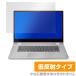 Ideapad C340 15 ݸ ե OverLay Plus for Lenovo Ideapad C340 (15) 쥢 ȿ ɻ Υ ǥѥå