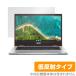 ASUS Chromebook Flip CM1 CM1400 ݸ ե OverLay Plus for  ֥å եå CM1 վݸ 쥢 ȿ  ɻ