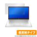 HP 17s-cu0000 ꡼ ݸ ե OverLay Plus for HP HP 17scu0000 HP Ρȥѥ վݸ 쥢 ȿ ɻ