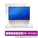 HP 17s-cu0000 ꡼ ݸ ե OverLay Absorber for HP 17scu0000 HP Ρȥѥ ׷ۼ ȿ ֥롼饤ȥå ֥С 
