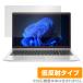 HP ProBook 450 G9 ݸ ե OverLay Plus HP Ρȥѥ Pro꡼ վݸ 쥢 ȿɻ  ɻ