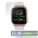 GARMIN Venu Sq 2 Music / Sq 2 защитная плёнка OverLay антибактериальный Brilliant for Garmin ve новый Sq2Music Sq2 антибактериальный .u il s высота глянец 