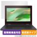ASUS Chromebook CZ11 Flip CZ1104F защитная плёнка OverLay Plus Lite fore стул -s хромбук высокая четкость жидкокристаллический anti g редкость отпечаток пальца предотвращение 