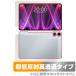 Teclast T60 Plus ɽ  ե OverLay Plus Premium for ƥ饹 ֥å å 쥢 ȿɻ Ʃ ɻ