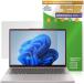 Lenovo Chromebook Plus Gen 10 14 type MediaTek защитная плёнка OverLay Plus Lite for Lenovo хромбук высокая четкость жидкокристаллический соответствует anti g редкость . покупка 