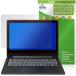 SHARP Dynabook Chromebook C1 защитная плёнка OverLay Brilliant for Dynabook хромбук жидкокристаллический защита отпечаток пальца . есть трудно высота глянец 