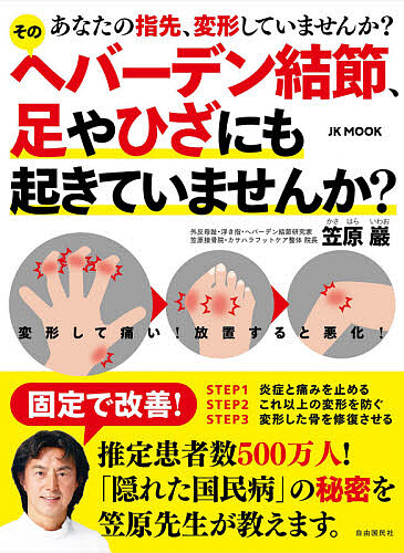 そのヘバーデン結節、足やひざにも起きていませんか？　あなたの指先、変形していませんか？ （ＪＫ　ＭＯＯＫ） 笠原巖／著の商品画像