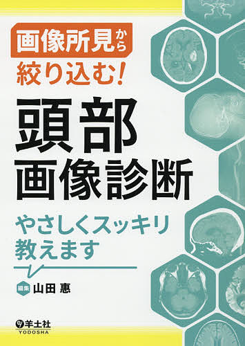 フェルソン読める！胸部X線写真 楽しく覚える基礎と実践 （フェルソン