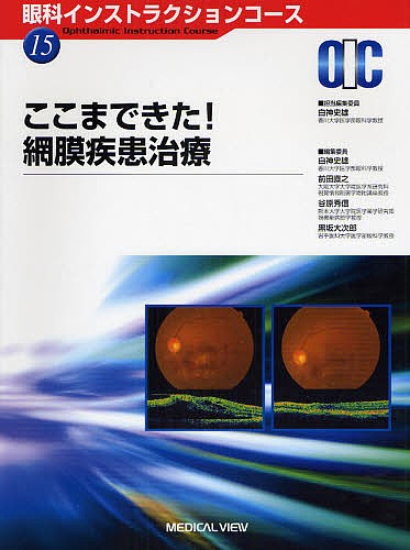 眼底図譜 カラーアトラス （第7版） 湯澤美都子／著 川村昭之／著 森