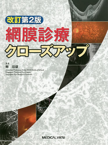 小切開硝子体手術入門！ これだけわかれば始められる 大島佑介／監修