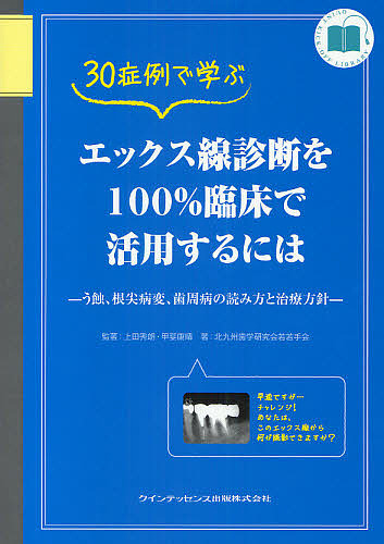 ３０症例で学ぶエックス線診断を１００％臨床で活用するには　う蝕、根尖病変、歯周病の読み方と治療方針 （ＱＵＩＮＴ　ＫＩＣＫ－ＯＦＦ　ＬＩＢＲＡＲＹ） 上田秀朗／監著　甲斐康晴／監著　北九州歯学研究会若若手会／著の商品画像